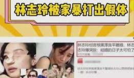 爆料林志玲被打视频,事件始末引发热议