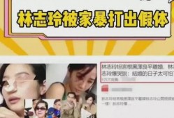爆料林志玲被打视频,事件始末引发热议